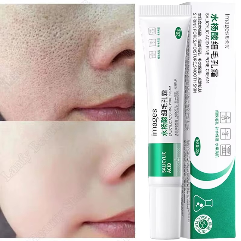 Salicylic Acid Blackhead Remover - Crème Nettoyante pour les Pores à