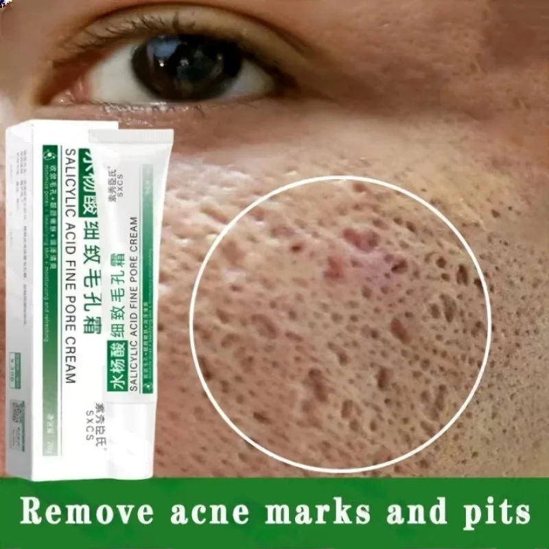 Crème de nettoyage des pores à - Salicylic Acid Blackhead Remover avis et prix